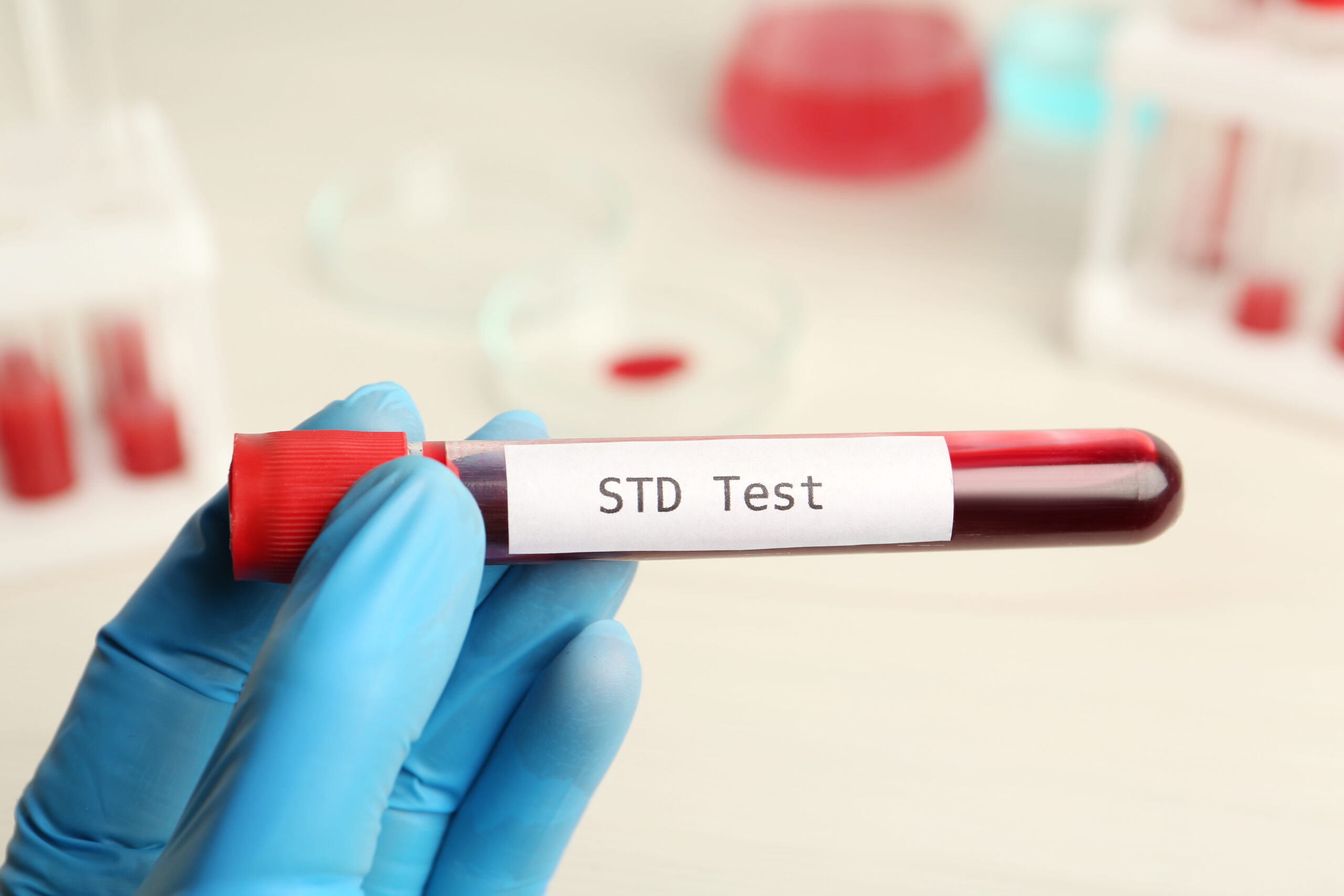 Eine Person hält ein Blutteströhrchen mit der Aufschrift „STD-Test“.